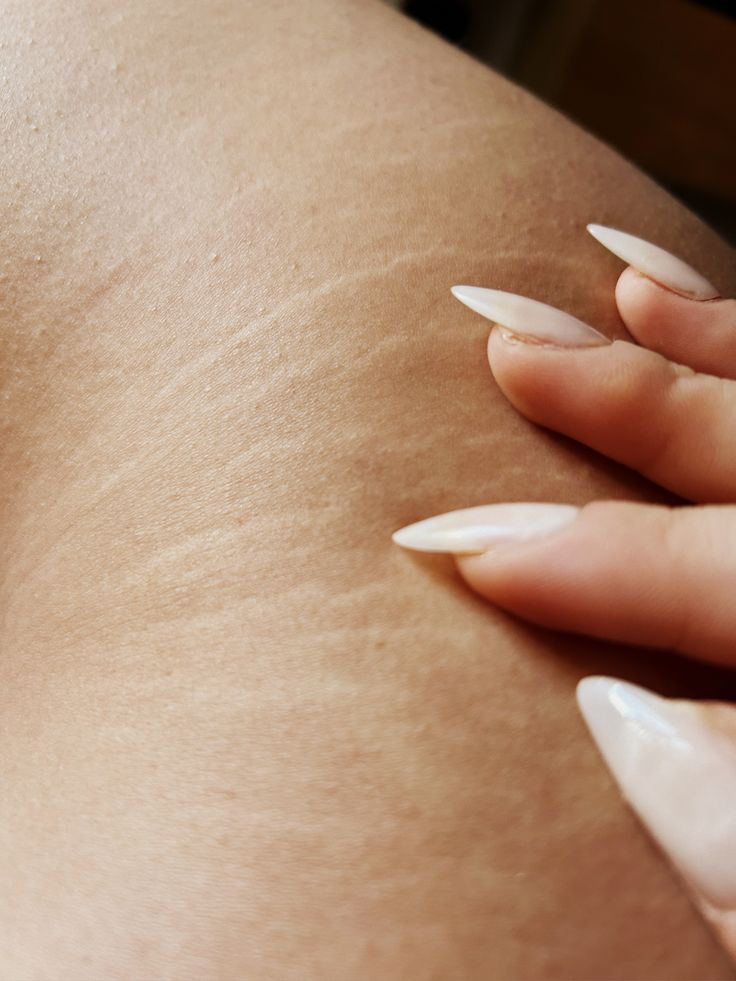 First-time Brazilian wax client at Beauty Bar by Mare, a cozy waxing studio in Spring TX specializing in hypoallergenic soft wax and smooth results.